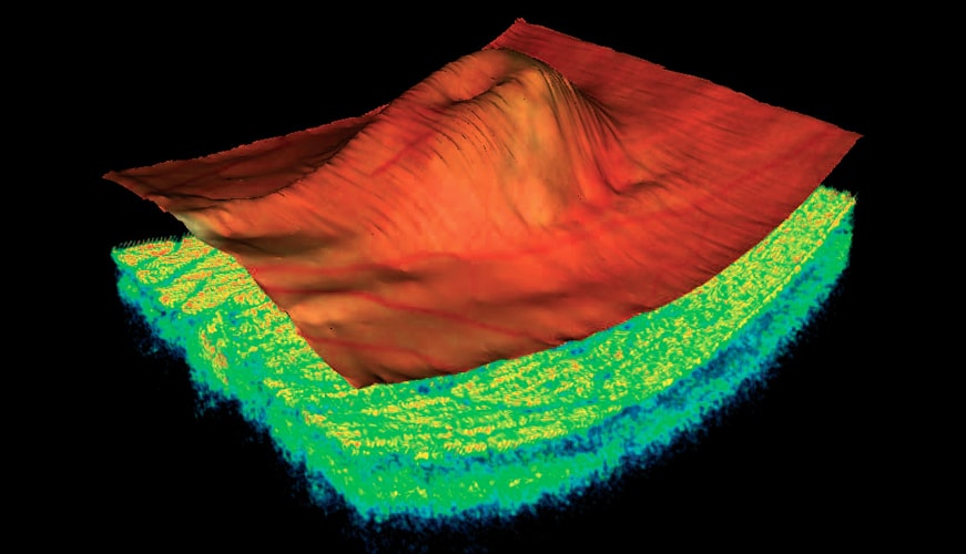 OCT 3D Eye Scans - Perspective Opticians Solihull